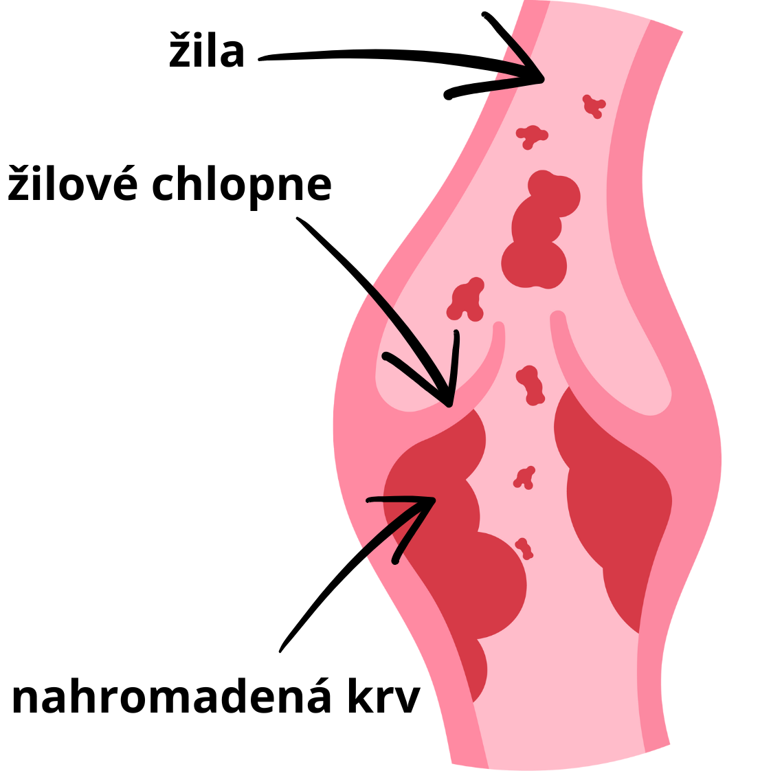 kefa na cievy pocit tazkych noh